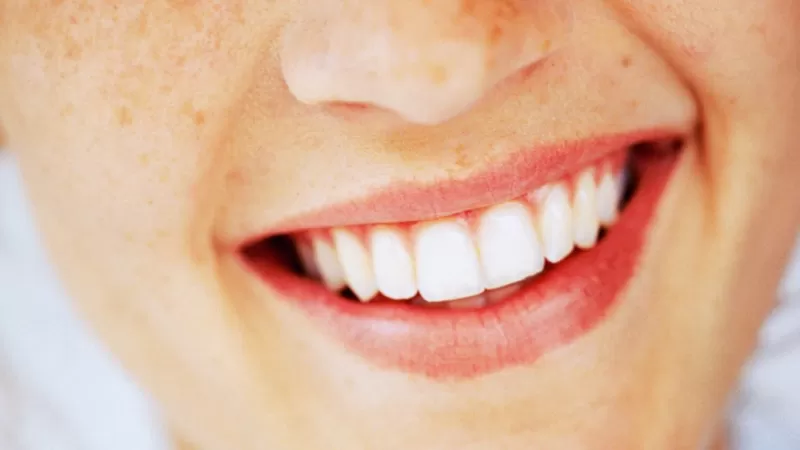 Periodontitis: el problema en las encías que puede afectar seriamente tu salud mucho más allá de tu boca