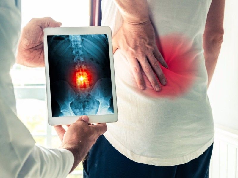 Ibuprofeno o paracetamol contra el dolor de espalda, ¿cuál es mejor?