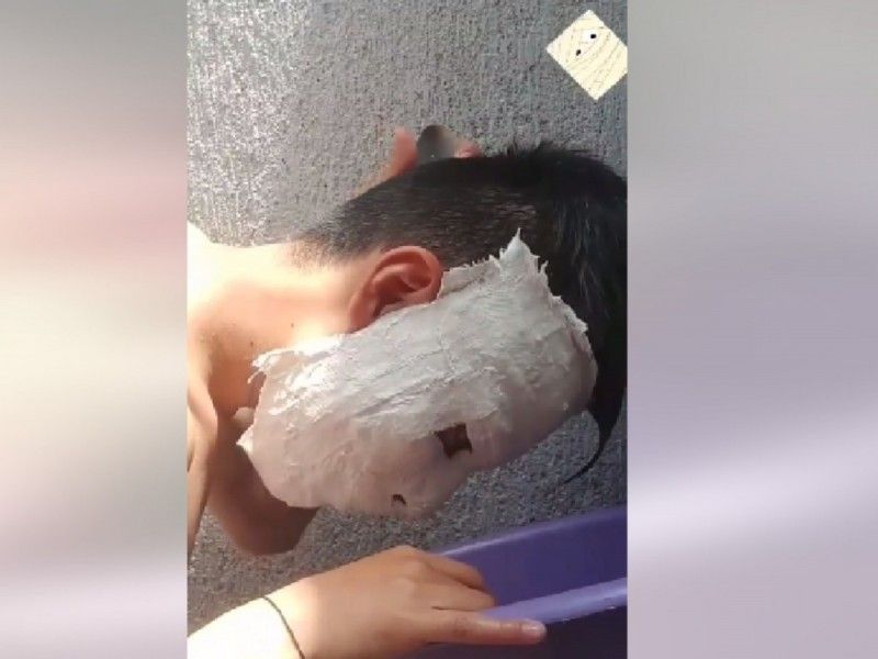 Estudiante se queda pegado a máscara de yeso y se viraliza