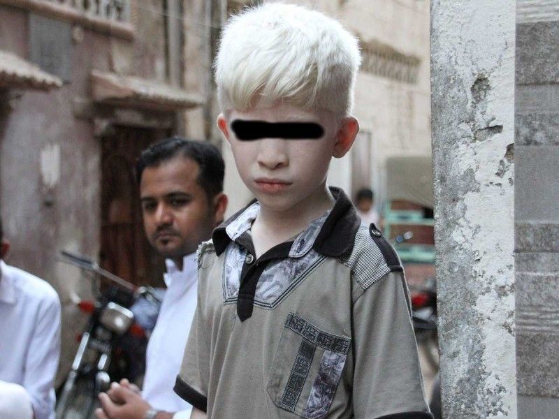 Detienen a hombre que intentó vender a sus hijos albinos para rituales de brujería