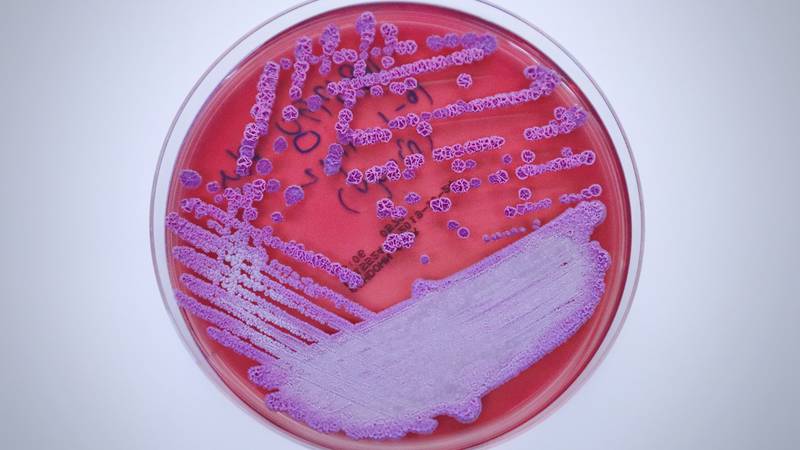 EU ‘enciende focos rojos’ por detección de bacteria que causa melioidosis