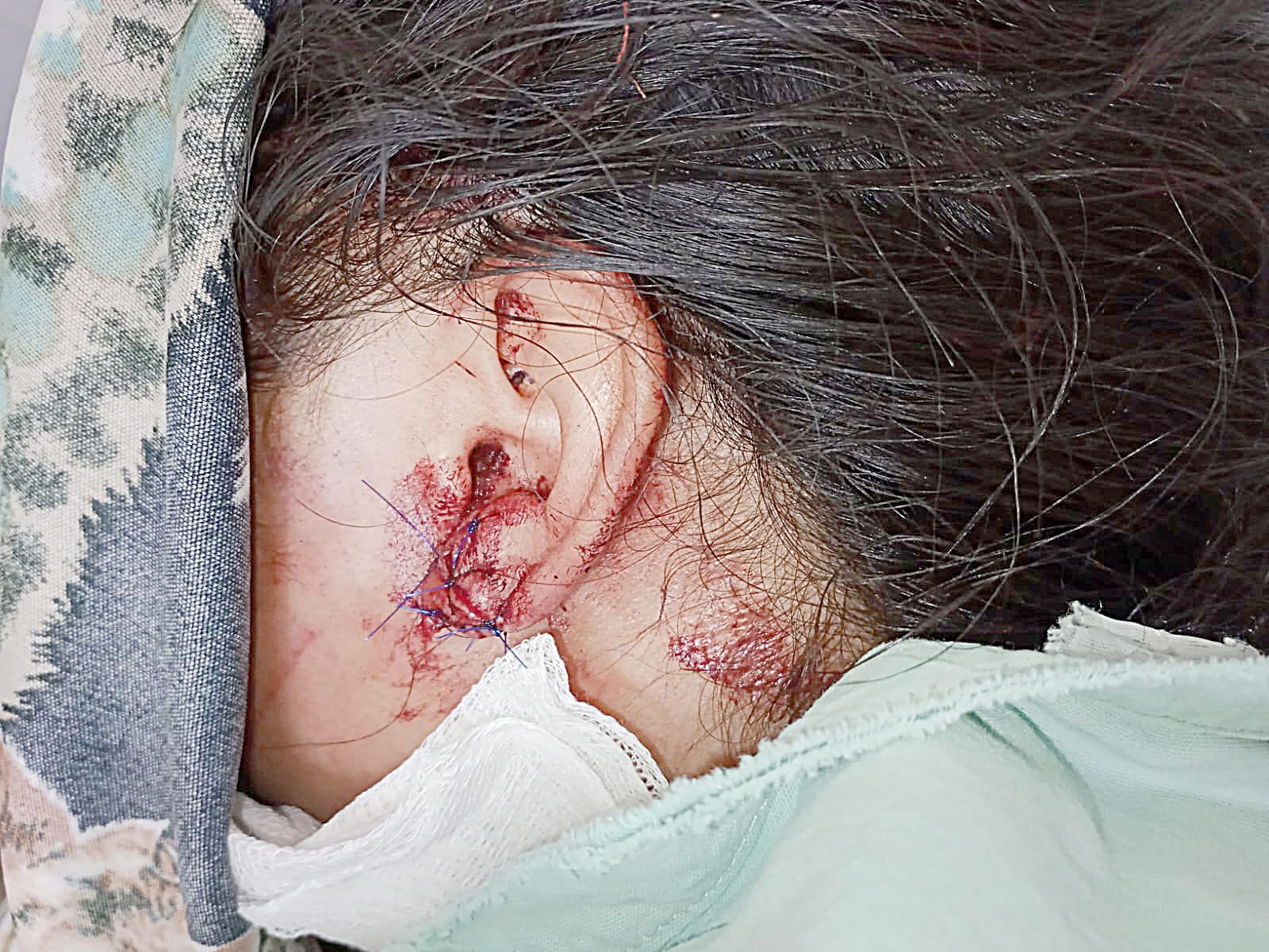 “Mi hija le pedía a Dios que mejor se la llevara”