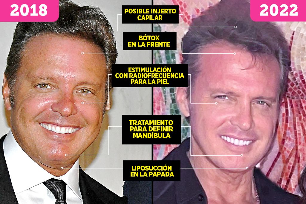 Rejuvenece Luis Miguel con ‘ayuditas’ y vuelve a brillar