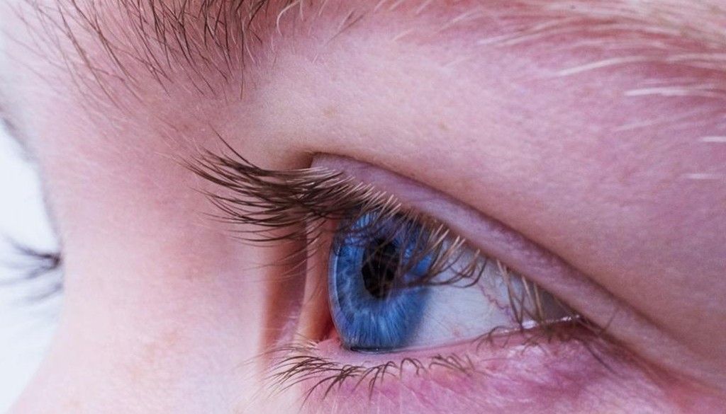 Viruela del mono: puede afectar a los ojos
