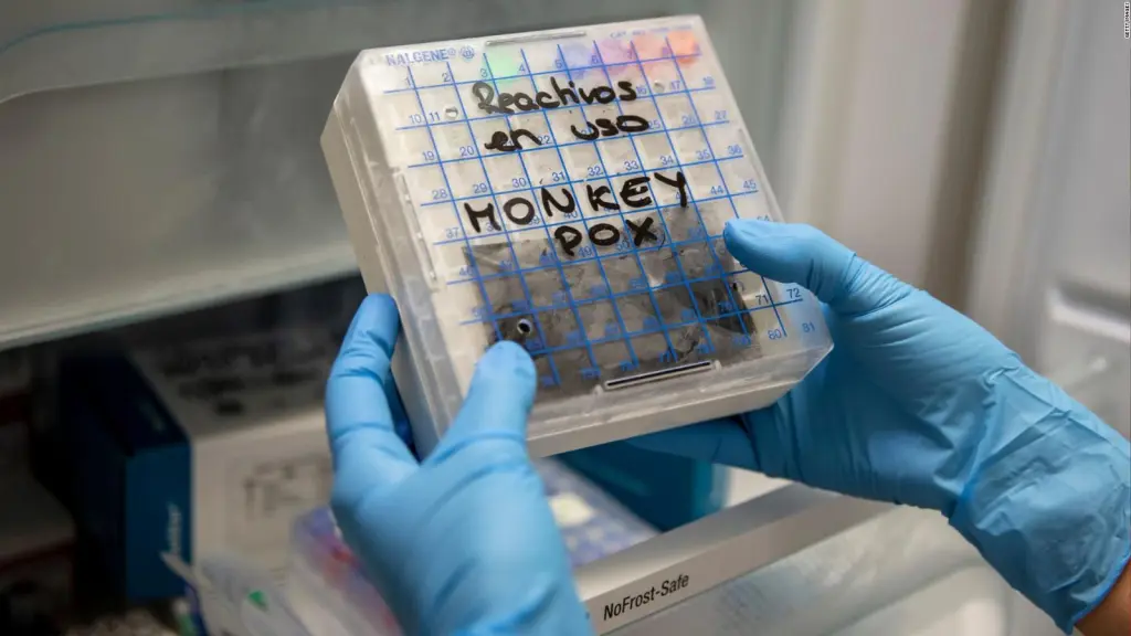 Estados Unidos declara el brote de la viruela del mono como emergencia de salud pública