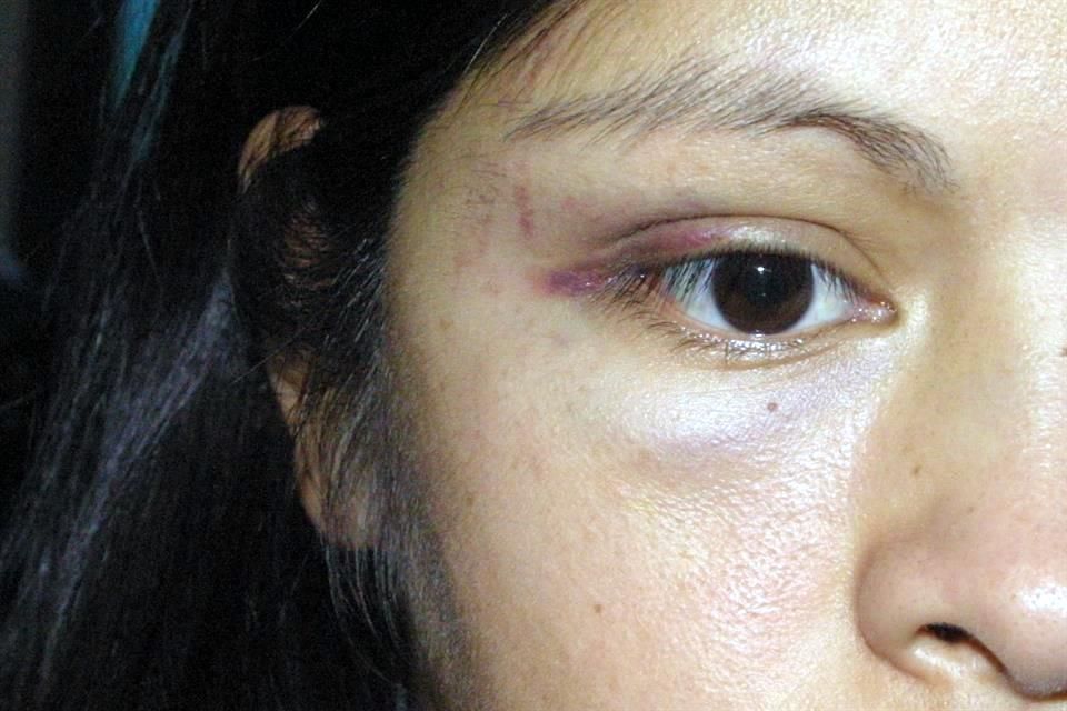 Las cifras de la violencia que sufren las mujeres