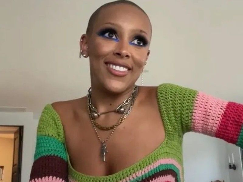 Doja Cat se rapa cabello y cejas; ¿fue por crisis mental?