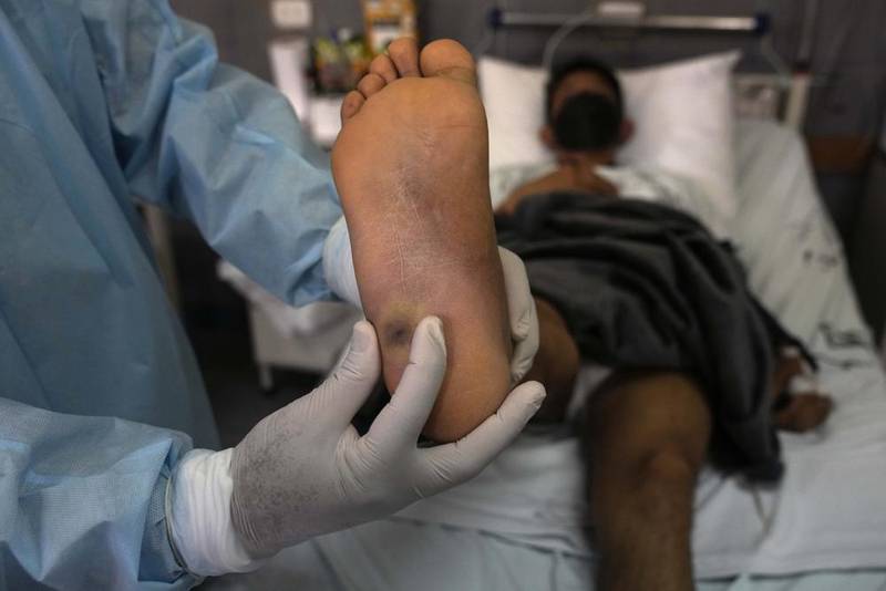 ¿Viruela del mono amenaza con convertirse en pandemia? Esto dicen especialistas