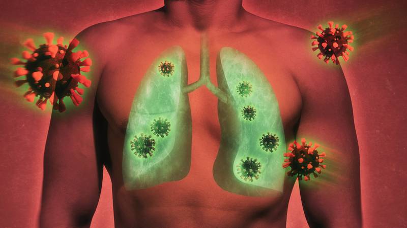 Si tuviste COVID que derivó en neumonía, el daño pulmonar persiste un año después: estudio