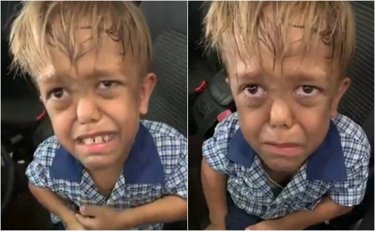 De sufrir bullying por su enfermedad a triunfar en Hollywood; esta es la historia de Quaden Bayles
