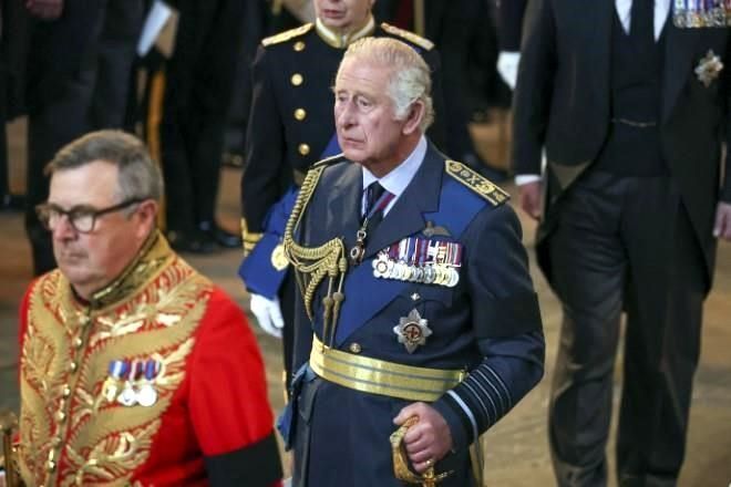 ¿Por qué el Rey Carlos III tiene ‘dedos de salchicha’?