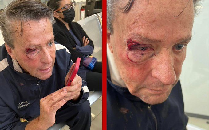 También en la CDMX a policía y un civil; golpean a Adame