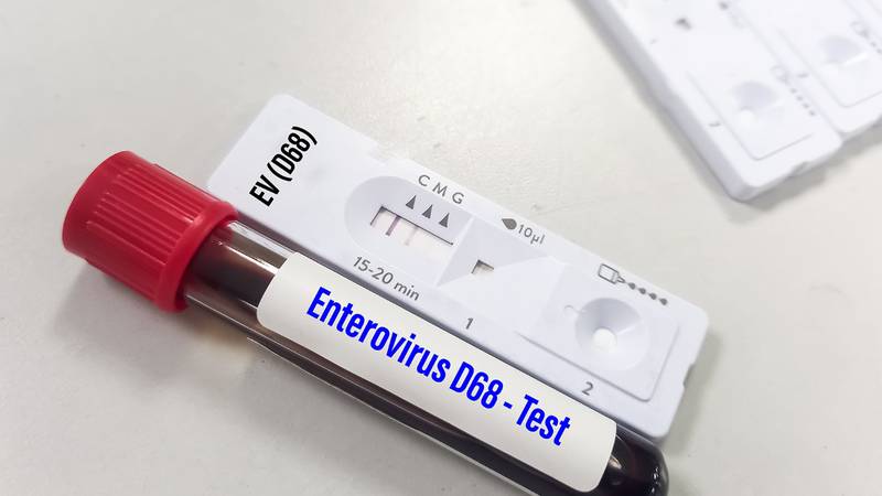 El virus acecha a niños y niñas: ¿Qué es el enterovirus y cuáles son sus síntomas?
