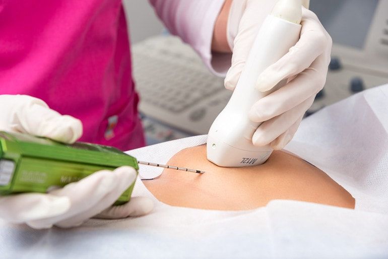 Biopsia de mama guiada por ultrasonido fundamental para caracterizar lesiones de seno