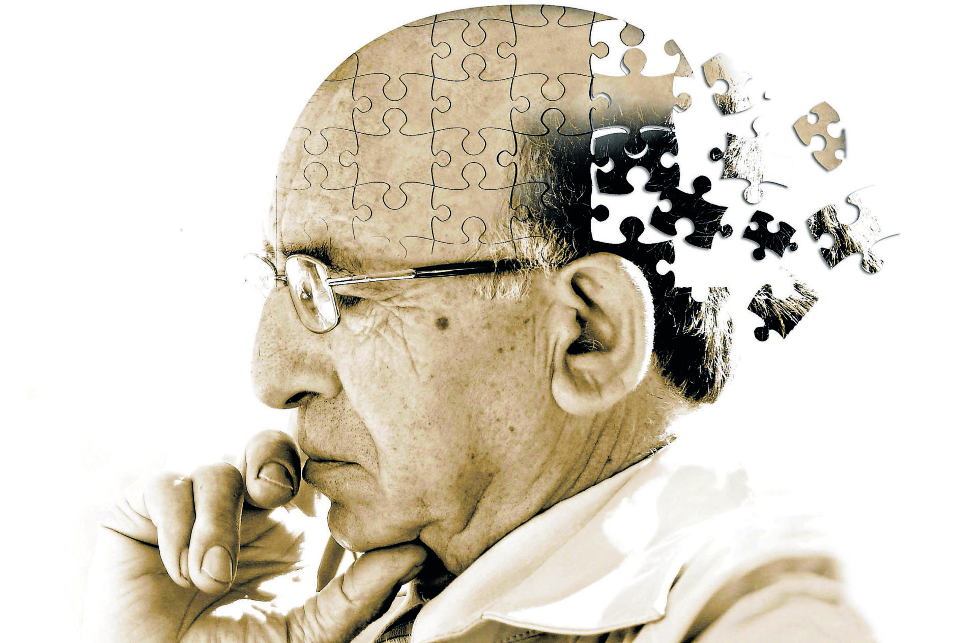 Identifican nuevo enfoque que podría frenar el Alzheimer