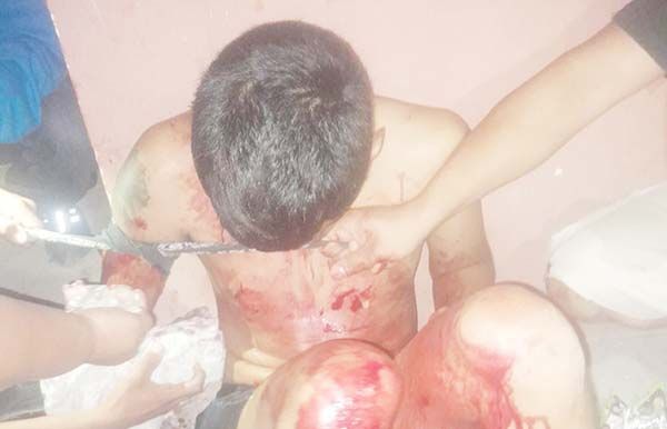 Policía lo deja bañado en sangre