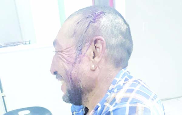 Pareja lo navajea y apedrea en cabeza
