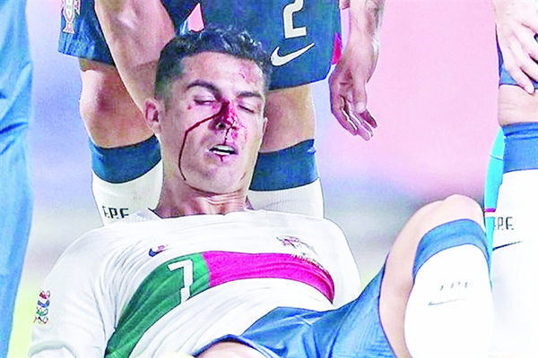 Cristiano Ronaldo sufre duro golpe en triunfo de Portugal