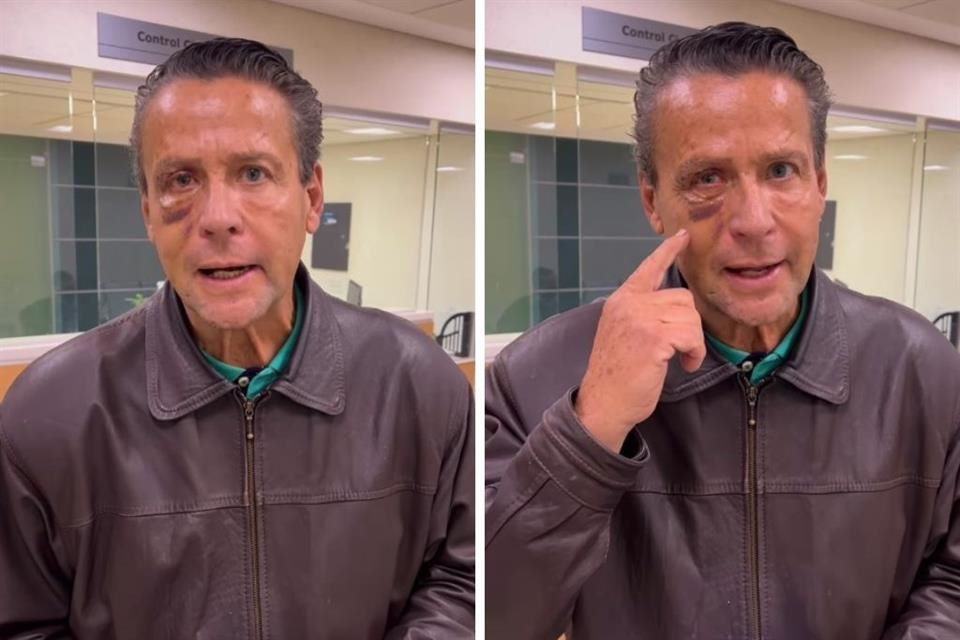 Operan a Alfredo Adame por lesiones en el rostro