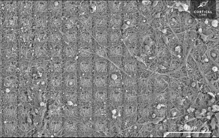 Ciencia médica: ¡Increíble! Neuronas de laboratorio aprenden a jugar un videojuego
