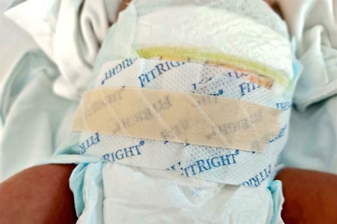 Acusan falta de pañales para bebés en el ISSSTE