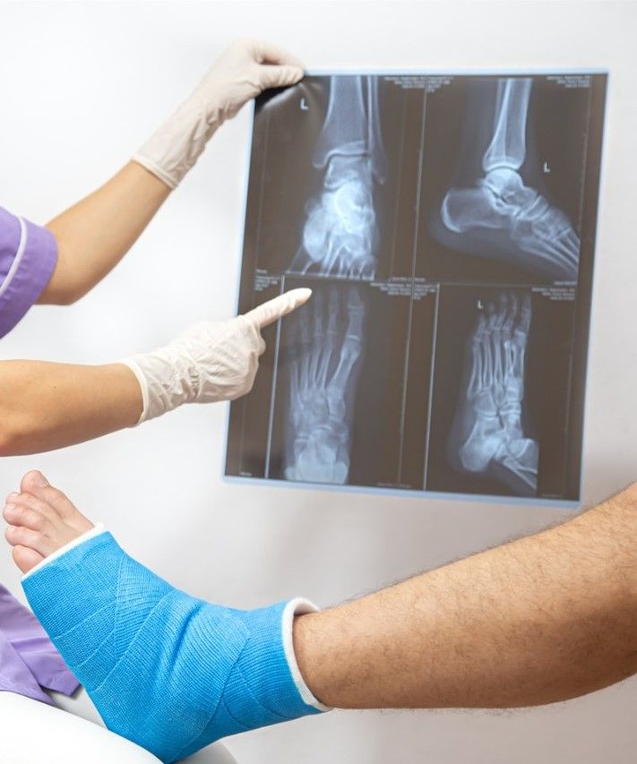 Prevenir osteoporosis es posible con dieta sana y práctica de deporte