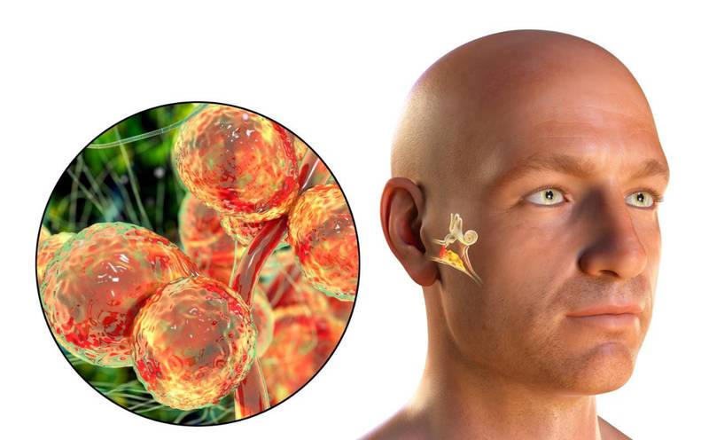 Candida auris: Así actúa el hongo mortal que se está propagando por todo el mundo