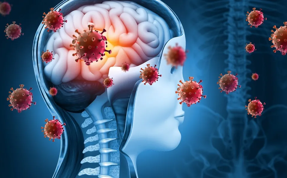 ¿Qué es la meningitis aséptica, enfermedad que suma 3 muertes y 33 casos en Durango?