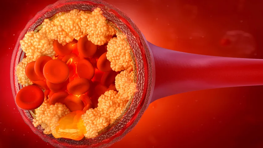¿‘Colesterol bueno’ sirve para indicar riesgo de enfermedades cardiacas? Esto dice un estudio