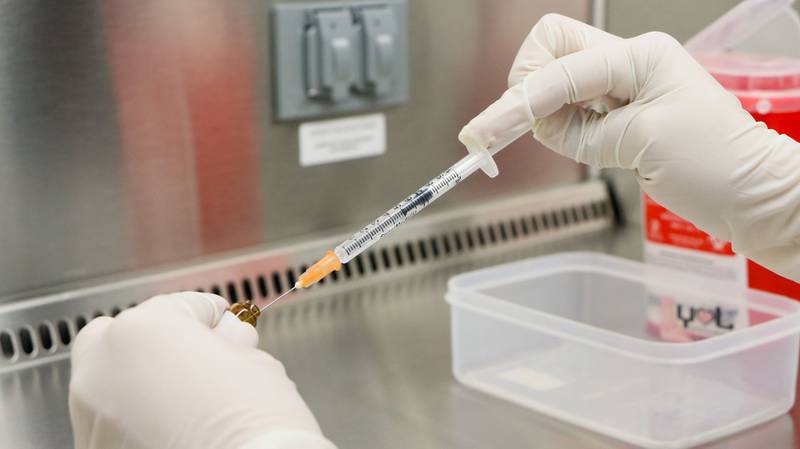 Estas son las tres fases de una infección por VIH, sus síntomas y posible tratamiento