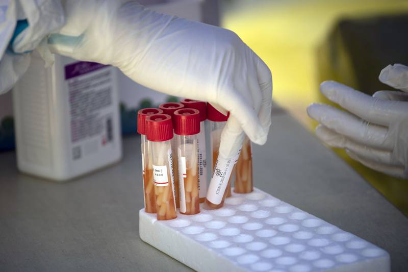 ¿Dónde ‘nació’ ómicron’, la variante del COVID-19 dominante en el mundo?