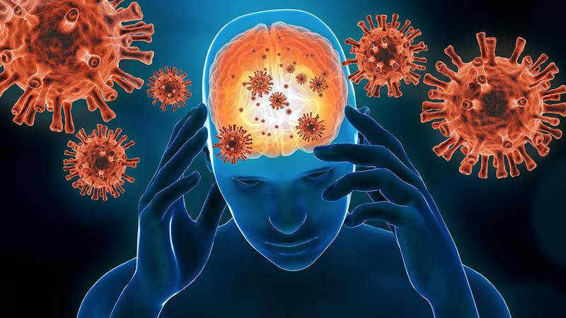 Casos de meningitis aséptica encienden las alertas en Guanajuato