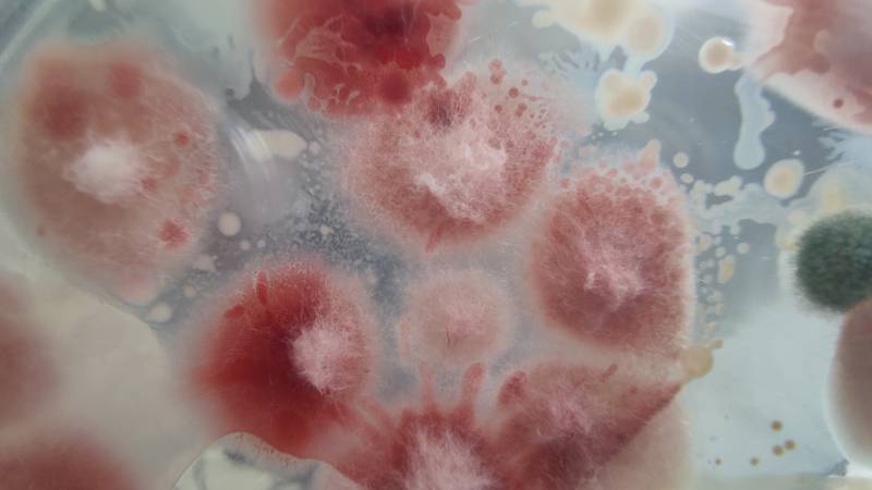 ¿Hongo fusarium solani está detrás de infecciones de meningitis aséptica? Esto sabemos