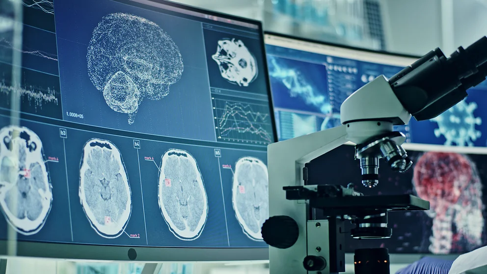 Cómo el COVID altera el envejecimiento del cerebro humano, según expertos de Harvard