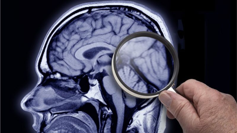 Cómo es la SLYM, la estructura del cerebro recién descubierta (y qué función tiene)