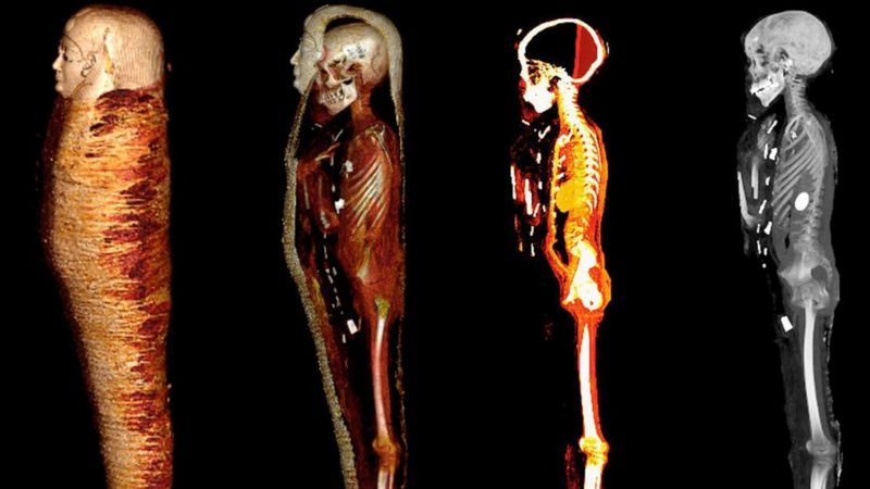 La momia que fue enterrada con un «corazón de oro» hace 2.300 años en Egipto