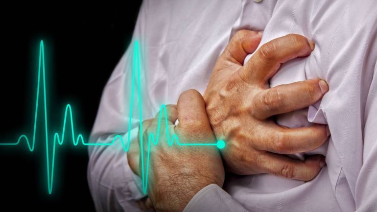 ¿Qué son el paro cardíaco, el infarto de miocardio y la insuficiencia cardiaca?