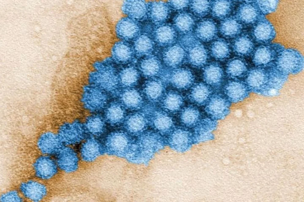 Qué es el norovirus identificado en el brote de gastroenteritis en Florinópolis: síntomas, riesgos y prevención