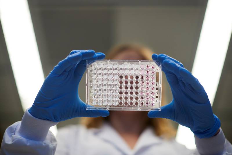 Esperanza para el cáncer de páncreas: Nuevo tratamiento inhibe células enfermas