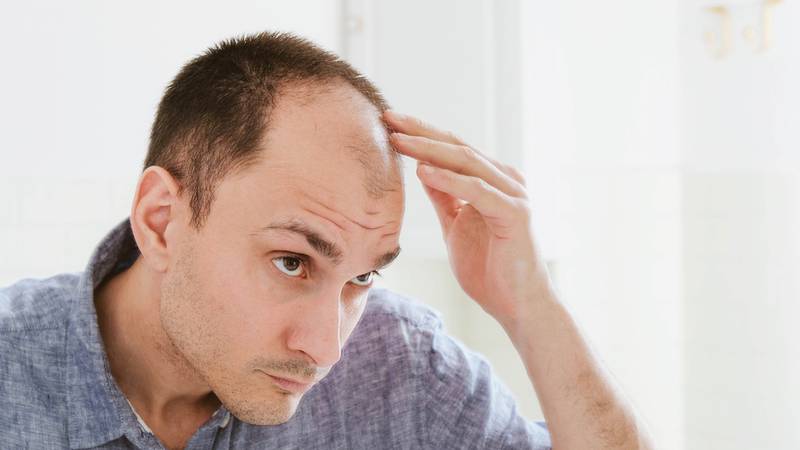 ¿Por qué tomar refresco puede provocar calvicie en hombres? Esto explica un estudio