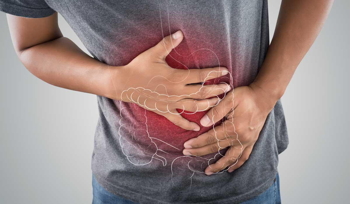 ¿Sufres colitis? Prueba estos remedios que recomienda la UNAM