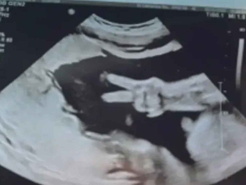 VIDEO. Bebé sorprende a sus papás con la señal de amor y paz en ecografía