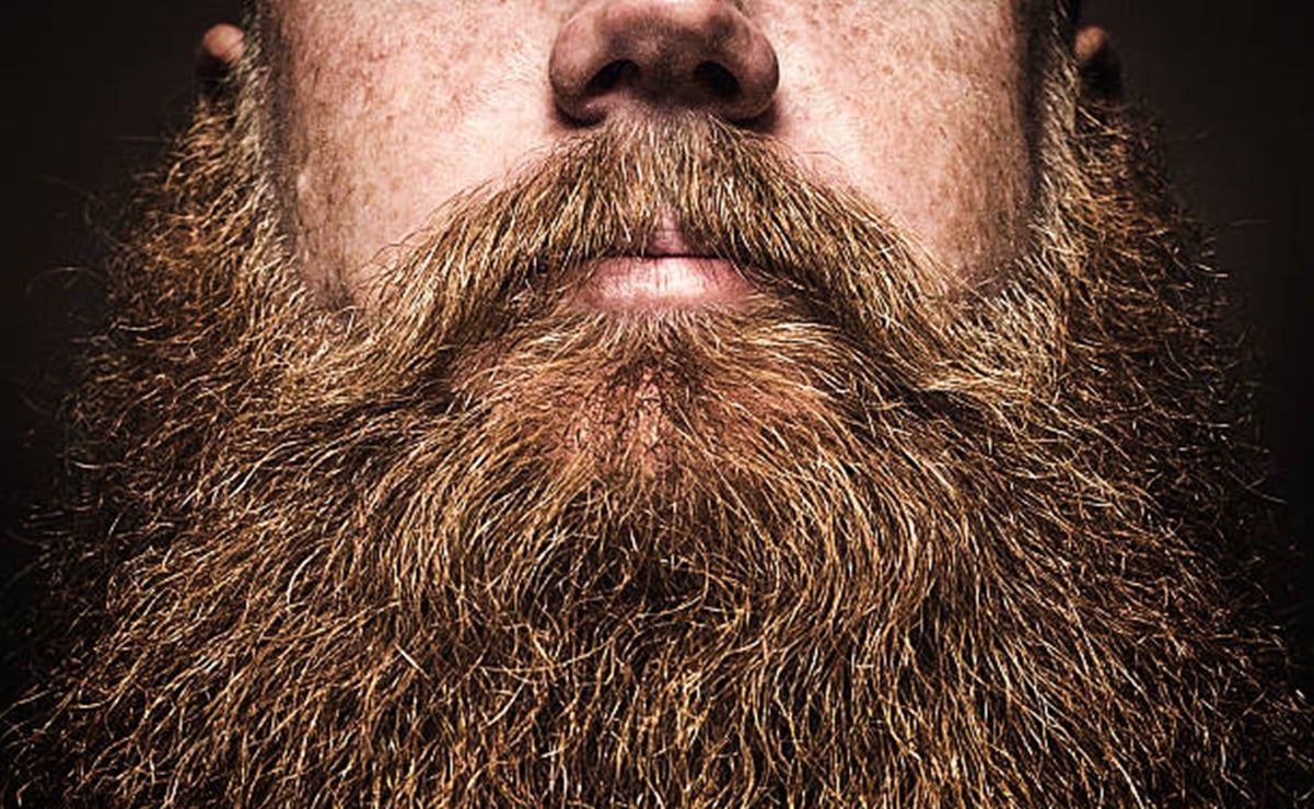 ¡Ten cuidado! La barba y los besos pueden ocasionar problemas a tu piel