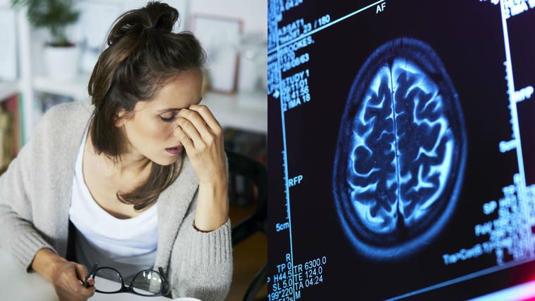 Cáncer cerebral: Estos son los síntomas y los tratamientos para la enfermedad