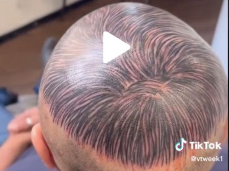 VIDEO. Casi no se nota: Se tatúa la cabeza para ocultar calvicie y resultado se hace viral