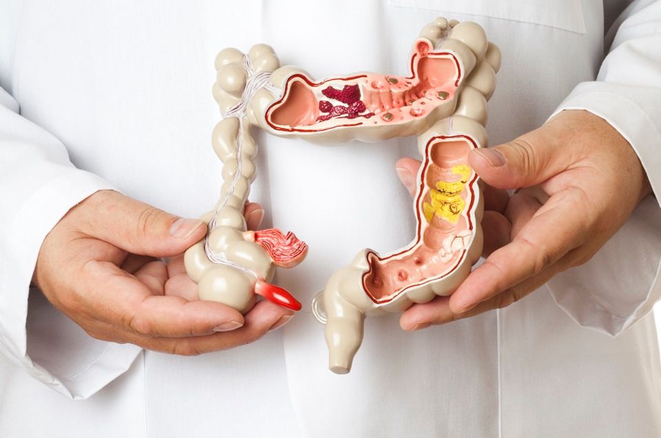 El cáncer de colon está en aumento en personas jóvenes: 5 claves para prevenirlo