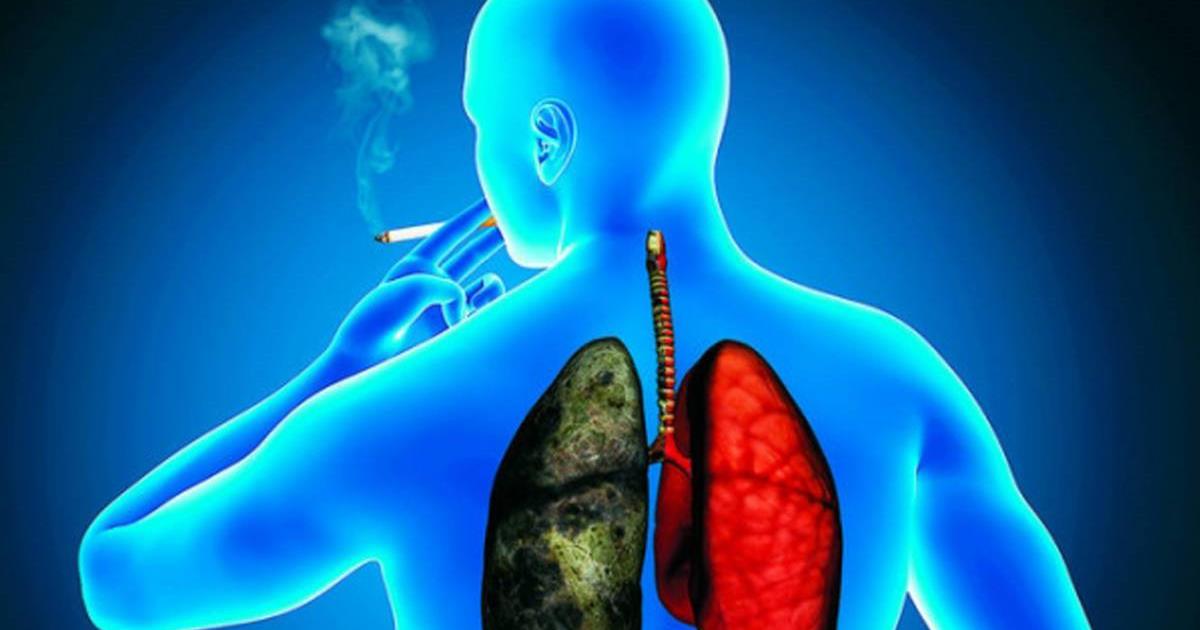 La contaminación del aire aumenta el riesgo de cáncer de pulmón en los no fumadores
