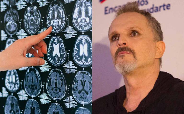 ¿Qué es sinestesia? El extraño padecimiento que tiene Miguel Bosé