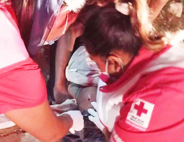 Le abren la cabeza tras desigual pleito