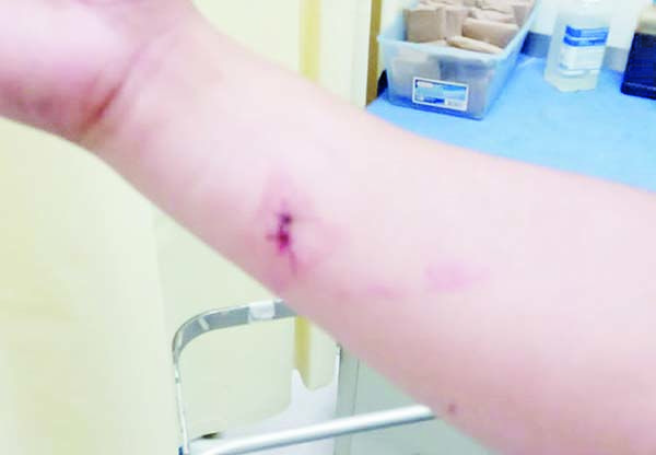 Lesiona toxicómano a policía preventivo